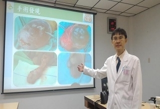 驚!老翁陰囊水腫 蛋蛋比拳頭大
