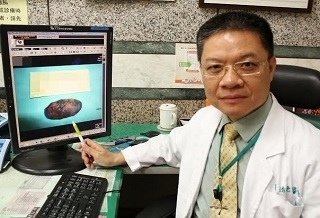 糞石阻塞小腸 老翁打嗝2天不止