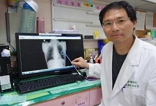 針灸完呼吸困難 治扭傷不成變氣胸