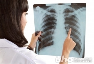 肺癌死亡率第1 好發於年輕不菸族