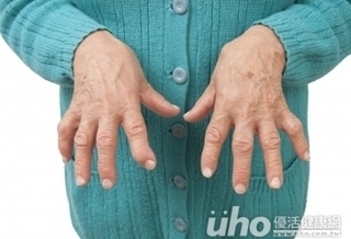 不痛就好? 輕忽發炎關節恐變形