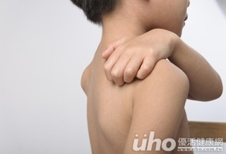 別亂吃! 小心蕁麻疹找上門