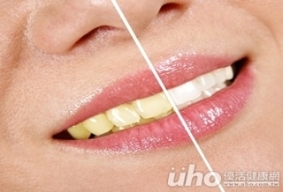 黃板牙好尷尬!飲食是根本原因