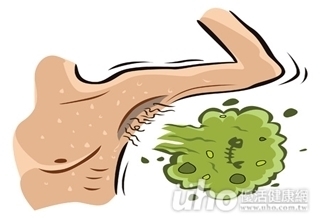 惱人狐臭! 恐化膿致汗腺炎