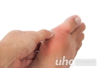 藥吃2年沒用?腳腫竟是脊椎炎!