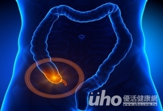 食慾差、發燒 闌尾炎恐致死