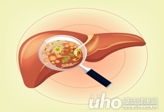 與友同桌吃飯 竟染急性A肝!