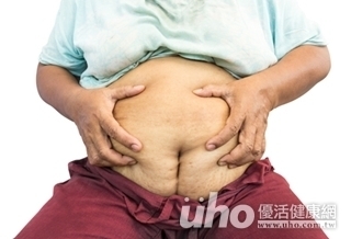 以為發胖 檢查驚現39公分腫瘤