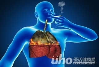 揪出肺癌 45歲起每年一次X光