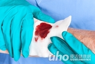 輕忽傷口 恐致壞死性筋膜炎