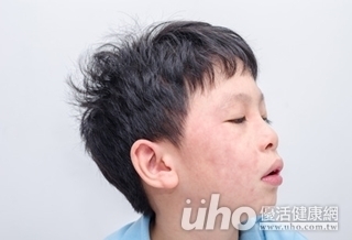 少吃豬頭皮 趕走皮膚疹!