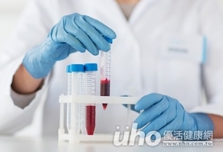 鐵質沉積危害大!骨髓化生不良症候群宜定期抽血檢驗