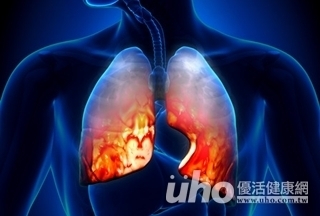 沒活力食慾差 當心肺炎上身