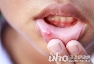 嘴破嘴唇腫 竟是羊肉爐害的!