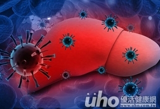 C型肝炎治療不能拖 小心肝癌找上身