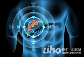 「肝」苦人有福!肝動脈導管納健保