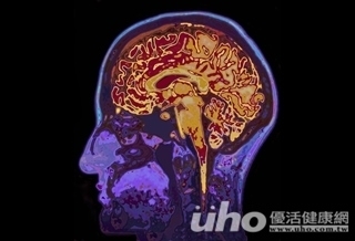 熱刺激後腦勺 活化延腦!