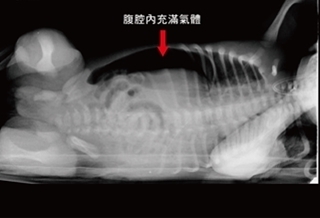 腹部氣脹 出生2天竟胃穿孔