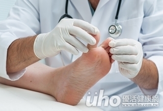 糖友長雞眼 細菌感染險截肢