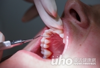 牙周有問題 心病、血脂風險指數增