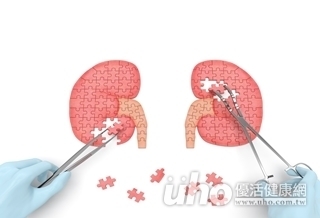 瘻管成熟手術 延長「腎」命線
