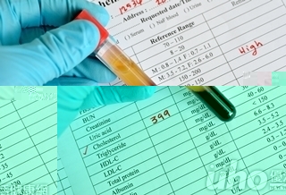 心包油　5萬人心病風險高20倍