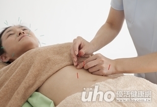 別吃藥!針灸治痛經更安全