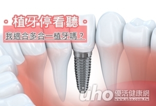 植牙停看聽 我適合多合一植牙嗎?