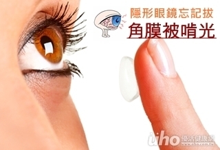 隱形眼鏡忘記拔 角膜被啃光