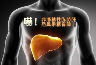 非酒精性脂肪肝 恐與果糖有關