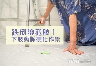 跌倒險截肢！下肢動脈硬化作祟
