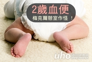 2歲血便 梅克爾憩室作怪!