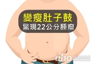 變瘦肚子鼓 驚現22公分腫瘤
