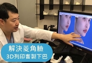 解決菱角臉 3D列印客製下巴