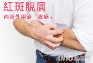 紅斑脫屑 內服外用治「皮癢」