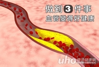 減緩血管老化 3件事要做到