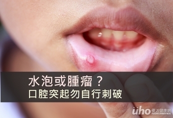 水泡或腫瘤?口腔突起勿自行刺破