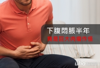 下腹脹半年 20公斤巨大肉瘤作怪