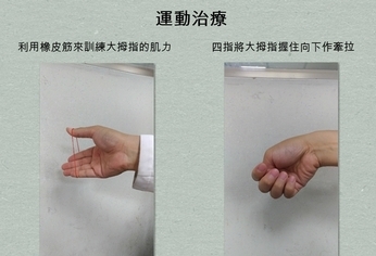 扭毛巾就痛 運動治療改善媽媽手