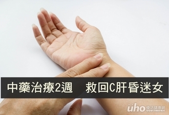中藥治療2週 救回C肝昏迷女