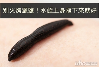 別火烤灑鹽!水蛭上身摳下來就好