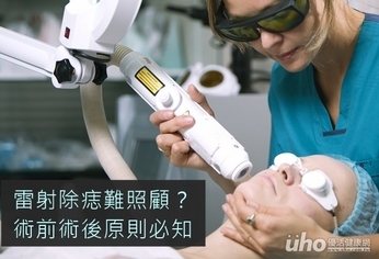 雷射除痣難照顧?術前術後原則必知
