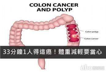 33分鐘1人得這癌!體重減輕要當心
