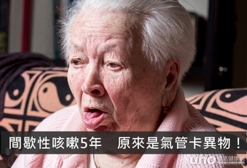 間歇性咳嗽5年 原來是氣管卡異物!