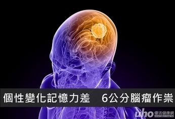 個性變化記憶力差 6公分腦瘤作祟