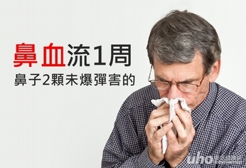 鼻血流1周 2顆鼻咽癌未爆彈害的