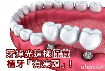 牙掉光這樣保養 植牙「有凍頭」!