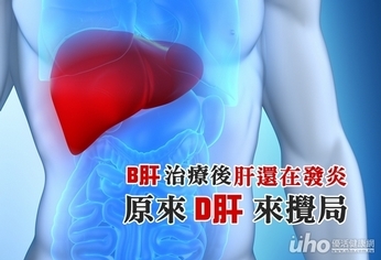 B肝治療後肝還在發炎　原來D肝來攪局
