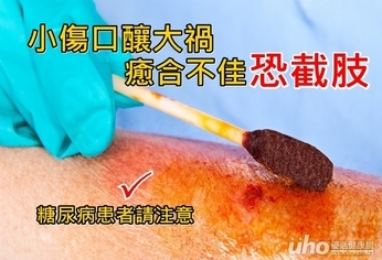 小傷口釀大禍 癒合不佳恐截肢
