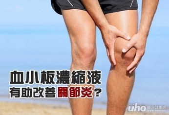 血小板濃縮液 有助改善關節炎?